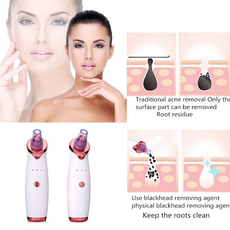 Blackhead Remover Instrument Black Dot Remover Acne Vacuum Suction.